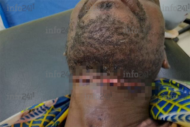 Gabon&nbsp;: Largué par sa copine, un quinquagénaire tente de se trancher la gorge à Tchibanga