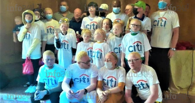 Alba célèbre en différé la journée internationale de sensibilisation à l’albinisme