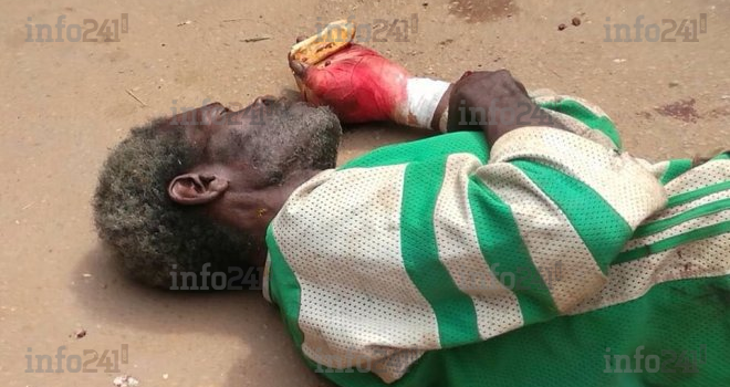 Tué par un chasseur, un gibier se transforme en humain dans un village du Gabon